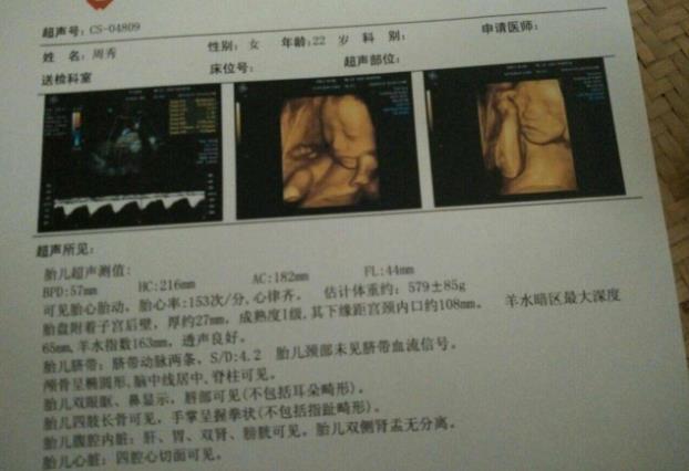 孕36周产检时，要记得让老公陪着一起去，要确定好这3件事