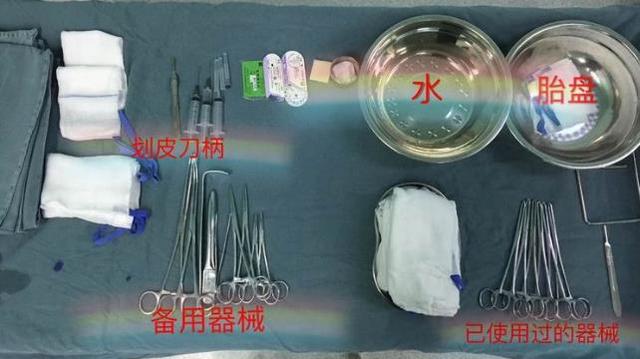 剖腹产只需打一针就好了？看看这场手术的器械和步骤，不寒而栗
