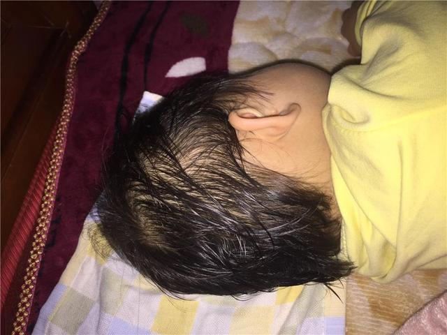 宝宝一睡着就大汗淋漓，是缺钙还是体质弱？宝妈别不当回事儿
