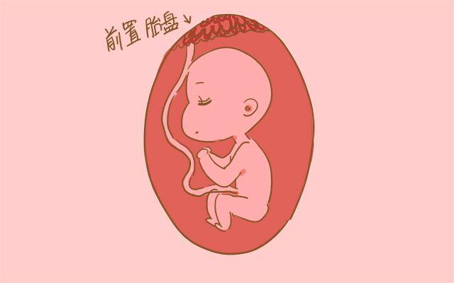 孕期多运动才能生得快？别盲从，这4类孕妈应该“赖”在家静养