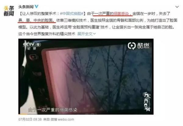 一次细菌感染竟让女童“毁容”？细菌感染or病毒感染早分清