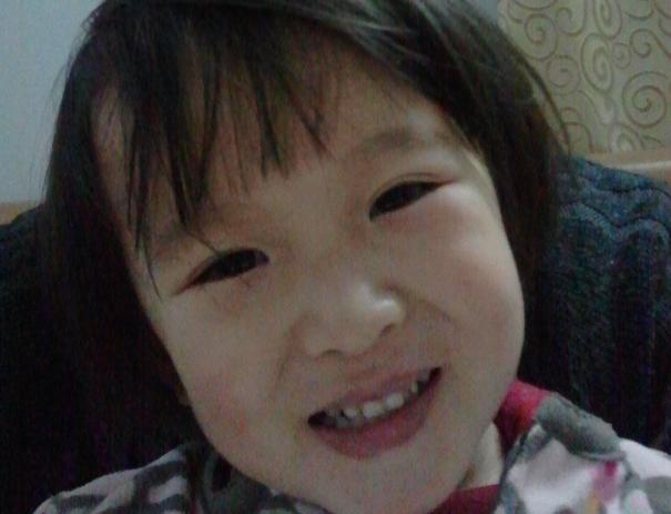 在奶奶家住了段时间，6岁女孩胸部隆起！妈妈发愁：都是吃出来的