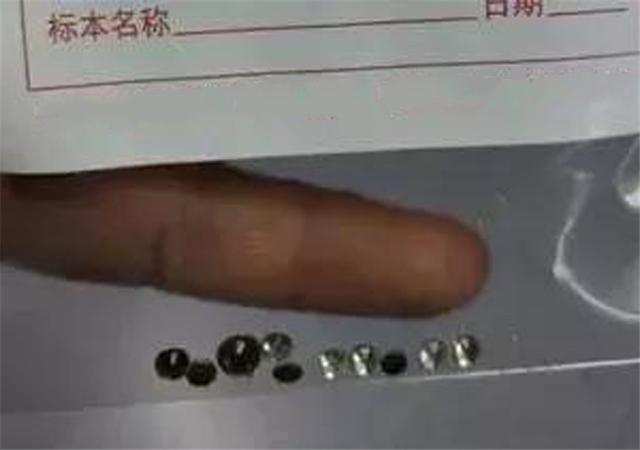 3岁小女孩把耳朵当口袋，塞了整整17颗“钻石”，家长该如何防范