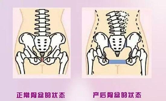 怀孕期间有一种疼痛，叫“耻骨疼痛”，孕妈妈耻骨疼痛该怎么办？