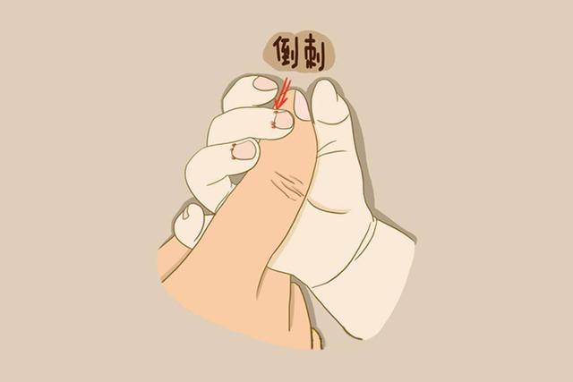 宝宝手上总长倒刺是缺乏维生素了吗？家长别急着乱补