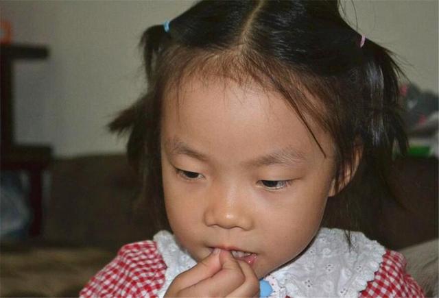 为啥孩子总爱咬指甲？专家坦言：可能是心理疾病，家长要注意