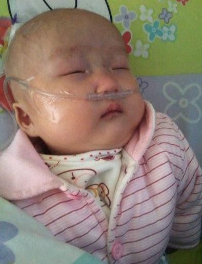 婆婆好心办坏事，致5个月孩子肠坏死，医生呼吁：家长别再犯糊涂
