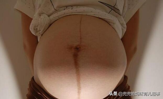准妈妈肚子上为什么会长黑线？医生：别觉得难看，意义非常大