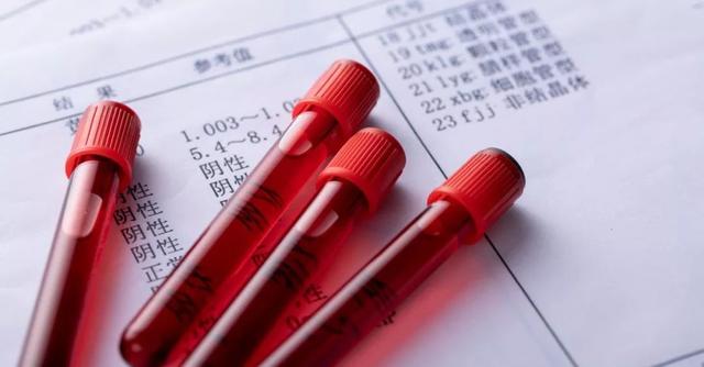 熊猫血的宝妈生二胎有风险吗？#清风计划#