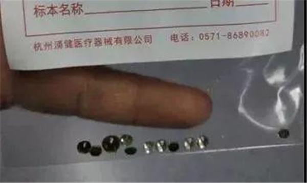 3岁女孩耳朵里塞17颗“钻石”，孩子的“器官”教育不能再忽视了