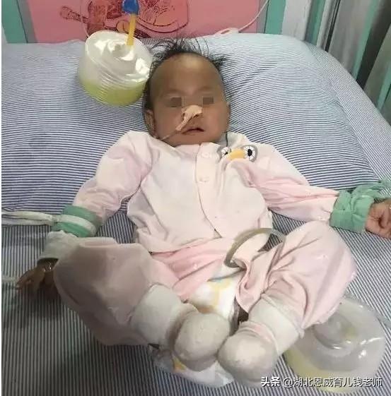1岁女婴胃被撑破，差点丧命！医生呼吁：别再强行给孩子喂饭了