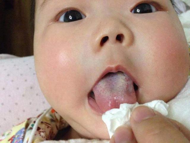 孩子出现8个症状，说明积食了！2个方子专门消食化积，健脾开胃