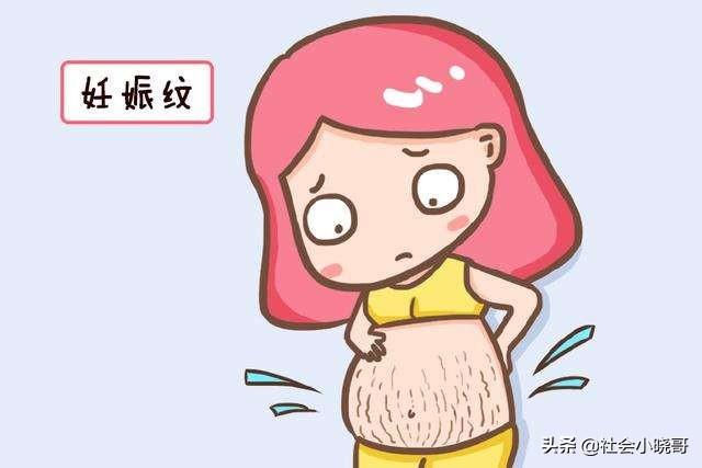 孕妈长不长妊娠纹，体质很关键，你知道吗？
