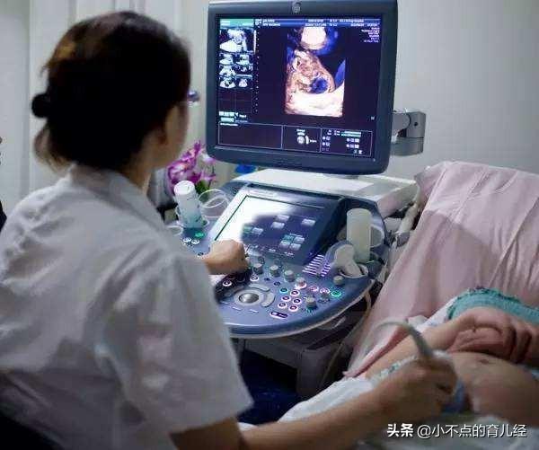 B超单上这5点，显示胎儿发育状况，孕妈产检时要心中有数