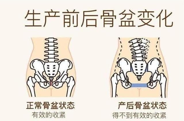 女人生孩子后，身体会出现这几大变化，宝妈们一定要重视