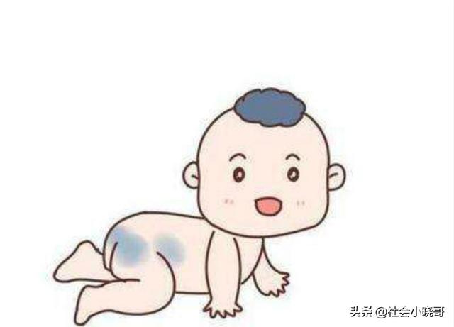 为什么有人会长胎记？有人却不长？这都是可以由孕妈决定的