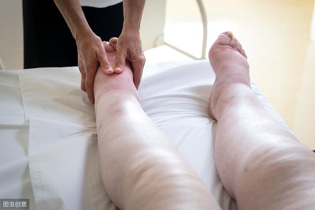 怀孕期间水肿严重其实是病态，你真的了解孕期水肿吗？