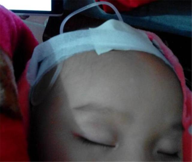 为什么有些孩子输液时，针头偏要扎在脑袋上，而不是手臂？