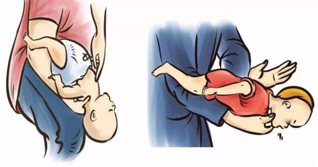 碰到异物卡喉该怎么办？医护人员教你“海姆立克急救法”