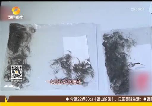 3岁女童胃口不好，结果让医生大吃一惊：1/4的胃被头发占满