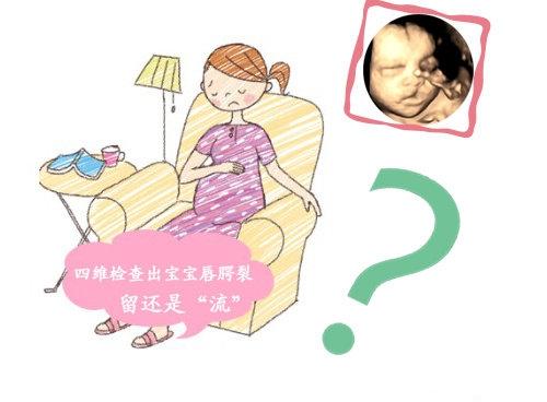 孕期四维彩超查出兔唇，全家人伤心，医生诊断：宝爸也脱不了关系