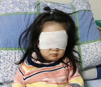 4岁女娃视力受损，只因石灰洒进眼睛，医生劝告：早学会3招娃没事
