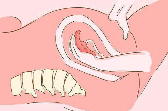 生完孩子，若“胎盘”没及时取出来会咋样？医生：那是在玩命