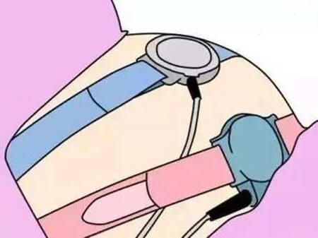 做胎心监护时，放在孕妈肚子上的“小圆饼”，有什么作用？