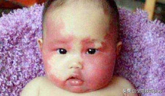 孕期别干这5件事，不然胎记找上宝宝，不想被孩子埋怨要重视