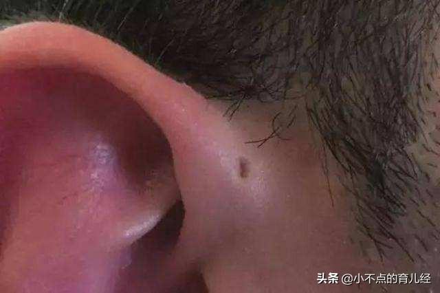 妈妈挤了一下宝宝的“富贵孔”，送医抢救2小时，别再无知了