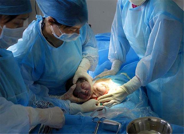 剖腹产和顺产，哪一个更痛？两种都经历过的二胎宝妈：不能比