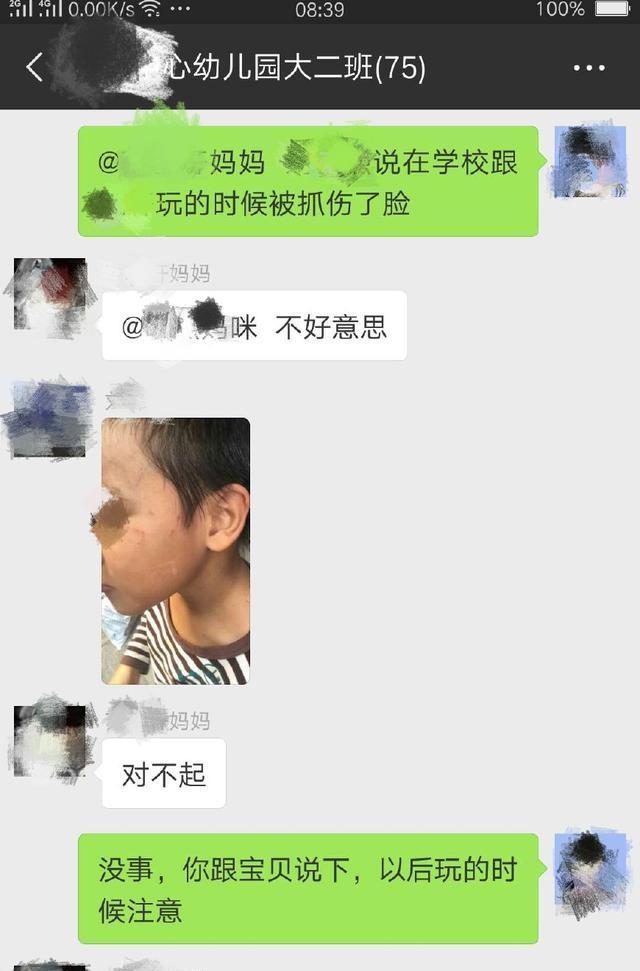 孩子从幼儿园回来脸花了，私聊无果只好发家长群了，结果事大了