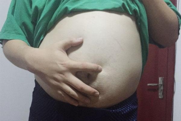 提醒：夜夜鼾声如雷，会隐藏哪些问题？怎么做？才能消灭鼾声！