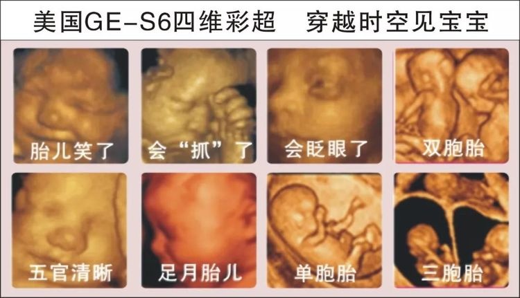 孕期重点检查项目四维彩超的好处和注意事项