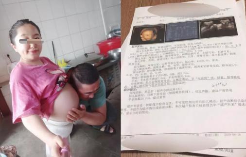 袖珍女拒绝引产，坚持生下畸形儿，网友：这不是母爱，是自私
