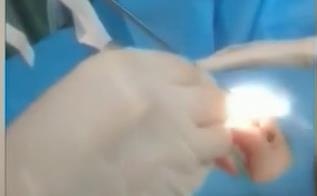 3岁女童流鼻涕不止，以为小感冒，检查发现鼻腔里竟有一厘米叠纸