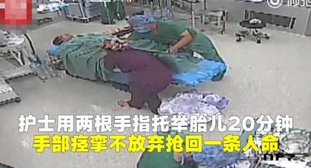 护士用手指托举胎儿20分钟，手部痉挛也不放，成功抢救婴儿生命