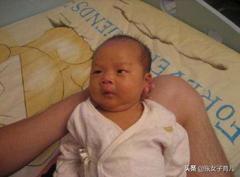 如果你怀孕了，避免做这3件事，宝宝出生后将远离黄疸皮肤好