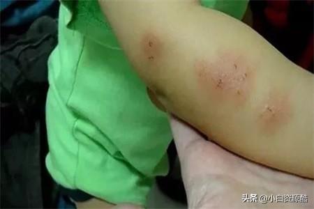 夏季如何驱蚊？一招让宝宝安睡