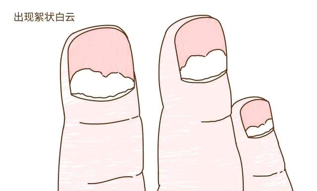 孩子有这几种表现，说明肠道有问题，家长忽视了孩子可能长不高