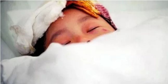 6岁孩子被“炸”得体无完肤！竟因书桌上每天必用的东西，很多家长都不知道