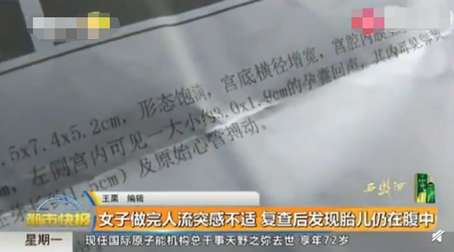 惊呆了！女子做完人流手术后胎儿仍在腹中，还在生长