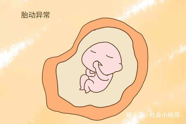 “羊水浑浊”一个可怕的事情，为什么会这样呢？孕妈要知道！