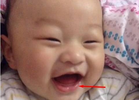 头上有这个“圆圈”的孩子，长大后有出息，乃富贵之相