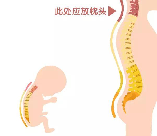 80%家长给宝宝睡错枕头！驼背、毁颈椎，还有窒息风险