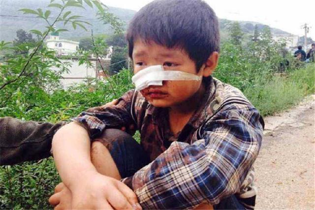 4岁男童无人看管，误把石灰撒眼，妈妈却让儿子眼睛灼伤更严重？