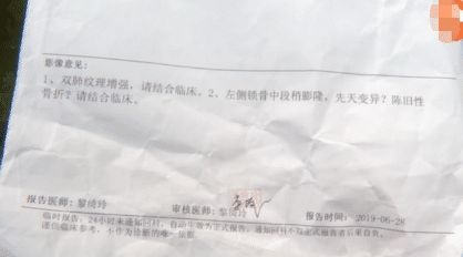 宝宝出生时锁骨骨折，接生医生却隐瞒病情，医生:这很正常