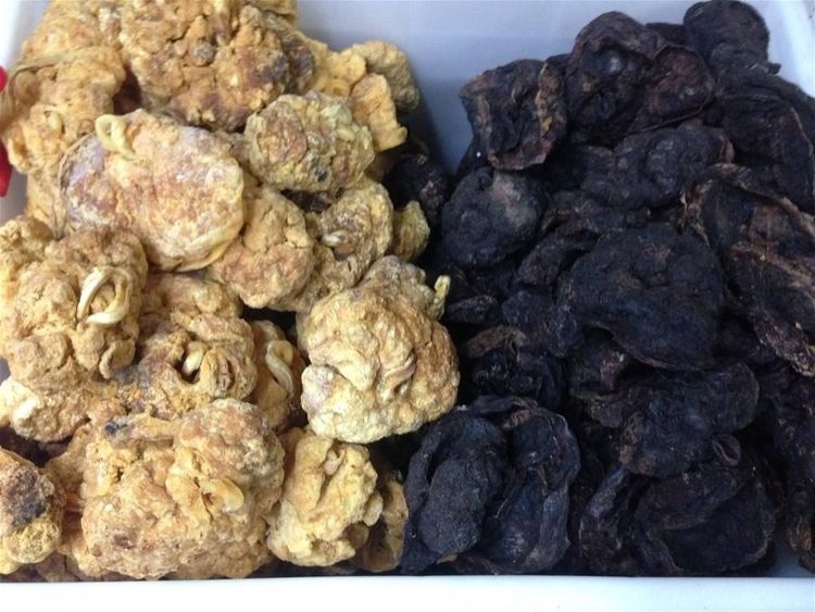 女性生完孩子后“胎盘”该怎样处理？产科大夫这样建议，别不上心