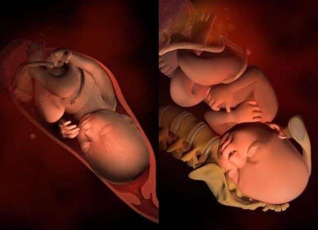 胎儿那么大，而产道那么小，胎儿是如何分娩出来的？