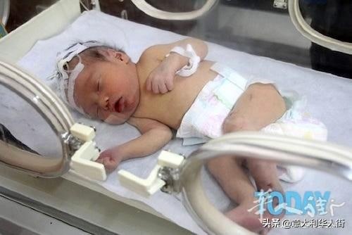 意大利孕妇去医院的半路上产下女婴